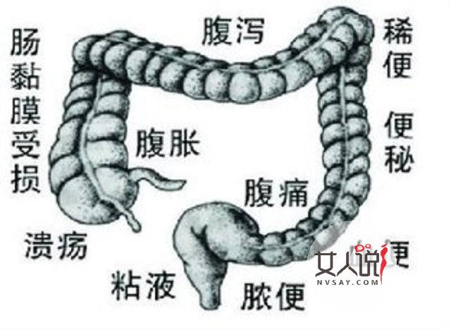 腸炎的這些你知道嗎？一起來看一下吧。