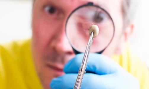 螨蟲(chóng)對(duì)床上的危害最大 去除螨蟲(chóng)的小方法