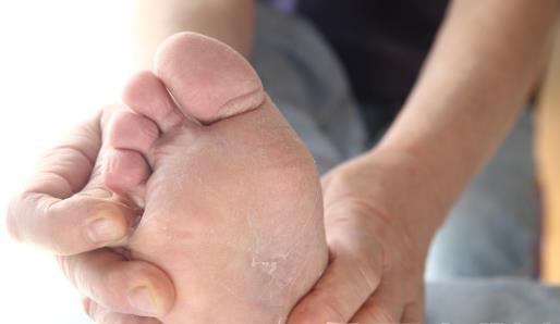 可惡的腳氣就是偏愛(ài)夏天 治療腳氣腳癬食療方