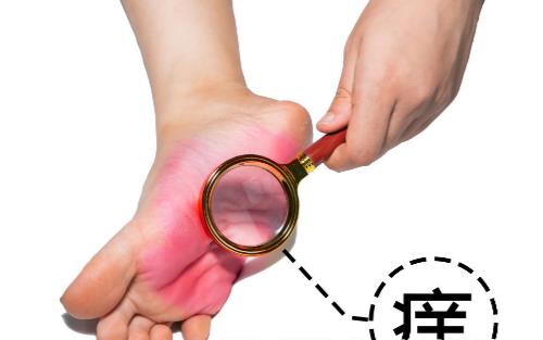 有腳氣經(jīng)常用鹽水泡腳能殺菌嗎 腳氣病用藥治療法則