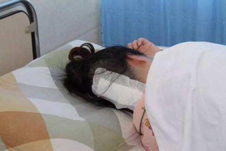 這五個癥狀要看懂別不管不顧 腦瘤早期什么癥狀？