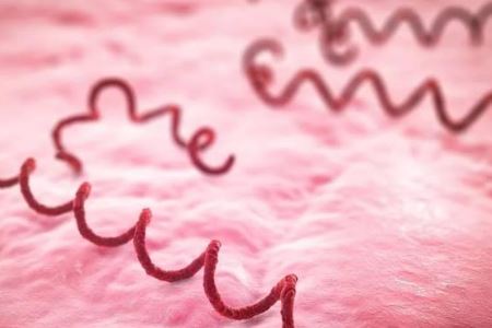 孕婦感染梅毒能順產(chǎn)嗎