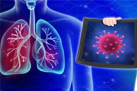 新冠感染者為什么不能居家隔離，病毒傳染性強