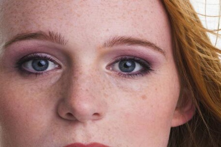 臉上長(zhǎng)斑是因?yàn)槭裁丛蛞鸬模窟@五個(gè)因素要改善治療好