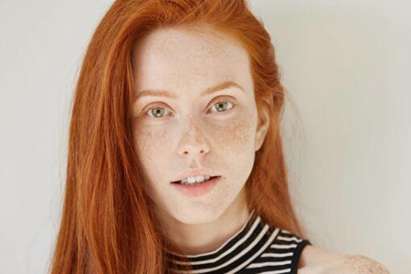 臉上長(zhǎng)斑是因?yàn)槭裁丛蛞鸬模窟@五個(gè)因素要改善治療好