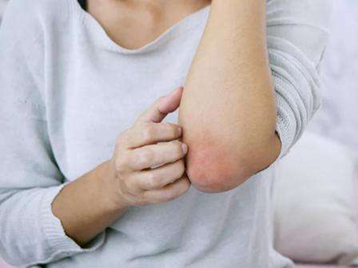 皮膚癢是身體哪里出問題了？警惕這幾種病！